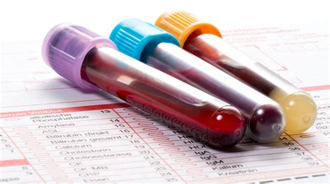 We did not find results for: Hemoglobin Tinggi, Apa Artinya Bagi Kesehatan Tubuh ...