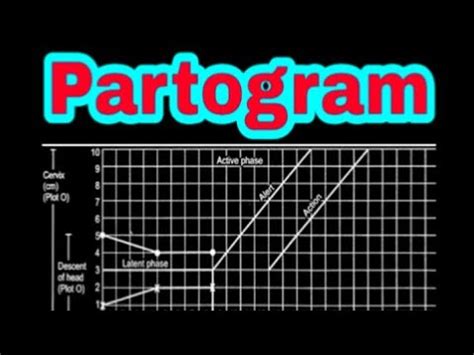 The central processing unit (cpu) consists of six main components Partogram - YouTube