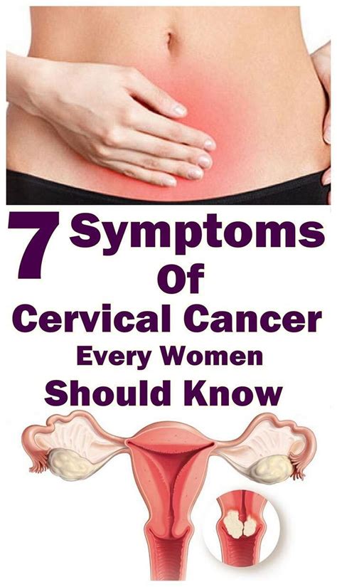 This may be a sharp pain or pressure and be located anywhere around the lower abdomen, below the belly button. 7 warning symptoms of cervical cancer that every women ...