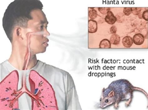 To assess the risk that travellers having visited the yosemite national park and resided in the affected area might develop hantavirus pulmonary syndrome (hps) and to assess. Hantavirus Prevention Control and Transmission Facts in ...