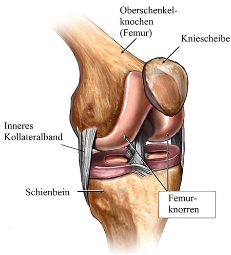 Meist sind sportunfälle die ursachen: Innenbandriss des Kniegelenks, Tapen, Symptome, Schiene