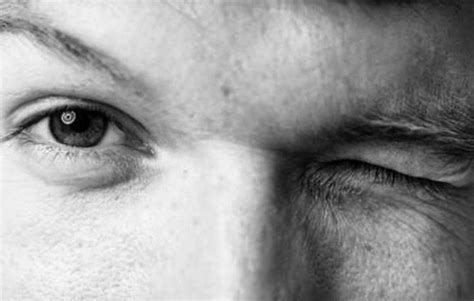 Mata yang sering berkedip di sebut blepharospasm. Tanda, Punca Dan Maksud Mata Bergerak-gerak