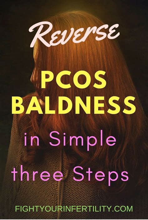 There's significant evidence that losing weight can lower androgen levels and reduce the effects of excess androgens in women with pcos. Reverse PCOS Baldness in Simple three Steps | Pcos ...