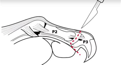 Anesthetization is risky for animals efficacy of declawing in cats. Declawing Cats - It's Not Clipping Nails | Two Crazy Cat ...