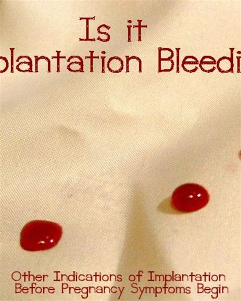 Mar 08, 2018 · however, not everyone will experience implantation bleeding or spotting. What Is Implantation Bleeding and How Long Can Spotting ...