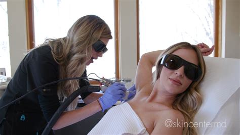 We believe that medical procedures such as laser hair removal and coolsculpting need to be performed in a safe environment, with experienced physicians and registered. Laser Hair Removal at The Skin Center - Jackie - YouTube