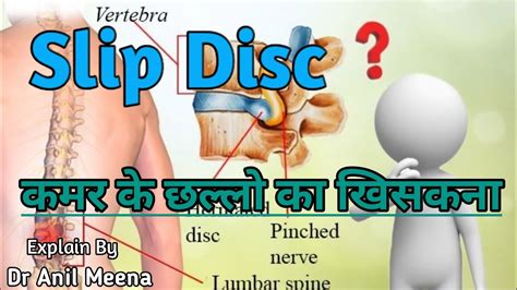 Yoga stretches and strengthens your body while developing body awareness. slipped disc | slip disc cause and treatment |herniated ...