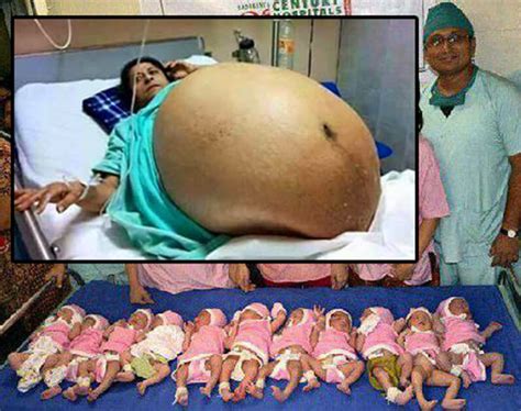 The government has been unable to confirm a report that a gauteng woman gave birth to 10 babies on monday. Mulher teve 11 filhos de uma só vez! Será verdade?