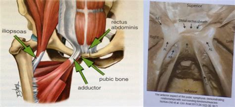 Each muscle below has the bones in bold for intermediate learners and the specific bony landmarks for advanced learners. Groin pain, treatment and terminology - by Sam Blanchard | RunningPhysio
