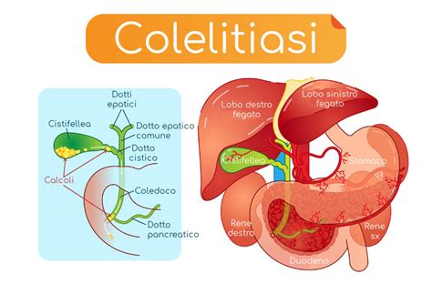 Adottare un regime alimentare che assicuri un peso corretto; Calcoli alla cistifellea (o colecisti): sintomi, dieta ...