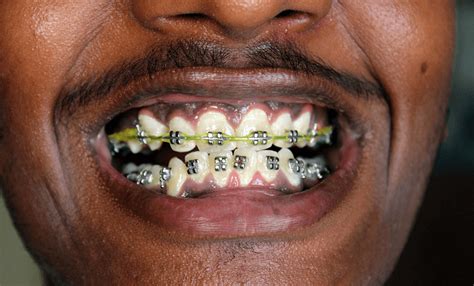 David you might be having a routine teeth cleaning when your dentist breaks it to you: Pin on Celebrity Biography