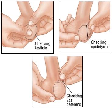A biopsy is the only way to tell for sure if you have cancer. Patient Basics: Testicular Cancer | 2 Minute Medicine