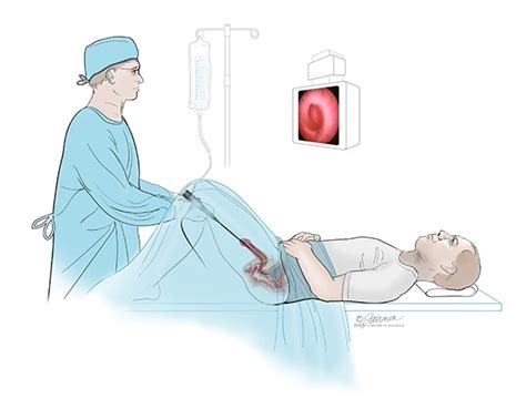 I like this video i don't like this video. Prostatitis (Infection of the Prostate): Symptoms ...