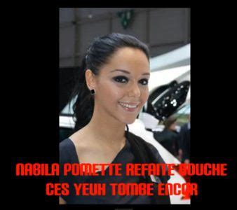 Vous comprendrez pourquoi elle a eu autant de succès. Nabila avant chirurgie 2