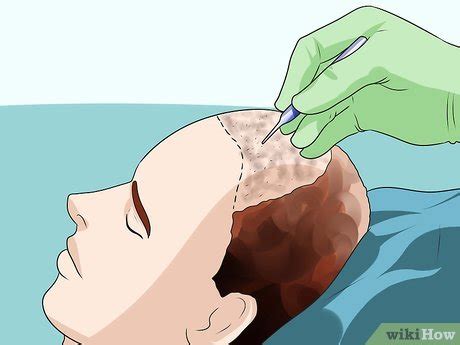 No matter what kind of shampoo you use, you should condition your hair to keep it from getting too dried out. 3 Ways to Treat Male Pattern Hair Loss - wikiHow