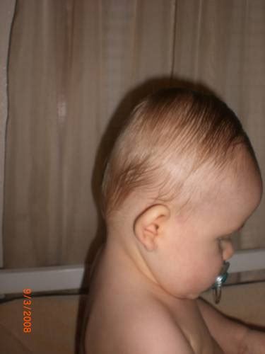 Bentuk kepala bayi baru lahir seringkali terlihat tidak bulat sempurna. Mencegah Kepala Flat Pada Bayi | BalitaMama