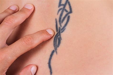 That is a great price considering the answer: How Much Does Laser Tattoo Removal Cost? - Still Waters ...