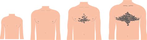 Menarche is usually reached between the ages of although usually breast development and growth of pubic hair proceed at similar rates, it is best to stage breast development separately from pubic. Chest Hair Growth Age - Cheat Dumper