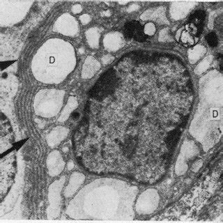 In mammals however, this organelle is not present in red blood cells and the endoplasmic reticulum is sheathed in a membrane, which is a phospholipid membrane. Mucous cell with dilated rough endoplasmic reticulum (D ...