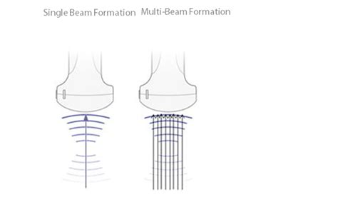 Previous works on edge detection models are reviewed and simulated. M7 Premium | Ultrasound General Imaging Systems| Mindray India