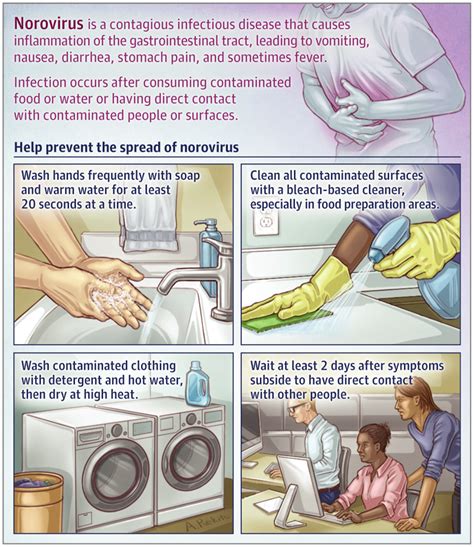 Norovirus is a highly contagious virus that causes more than half of all foodborne illnesses in the united states, according to the centers for disease control and prevention (cdc). Pin on JAMA Patient Information