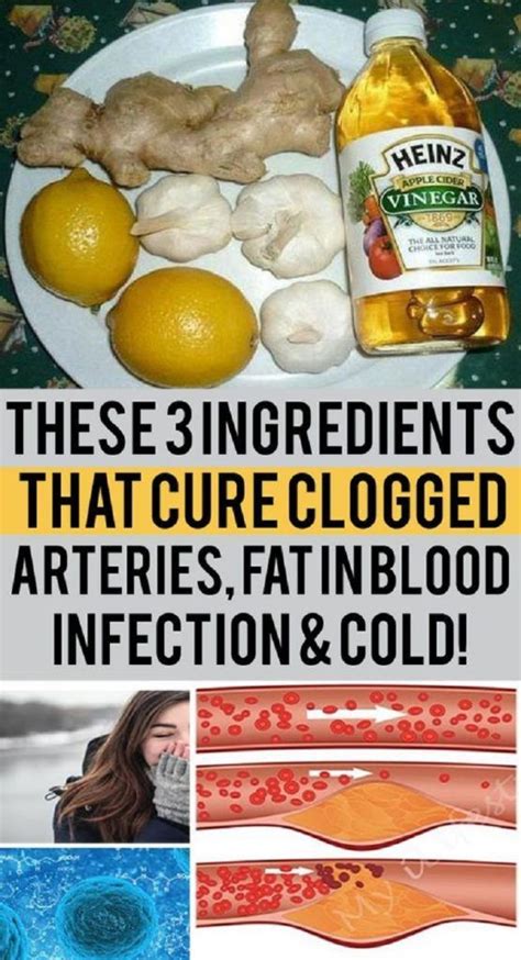 Experts agree that clogged arteries (atherosclerosis) decrease blood flow to your heart, which may cause chest pain and shortness of breath. 3 Ingredients That Cure Clogged Arteries, Fat In The Blood ...