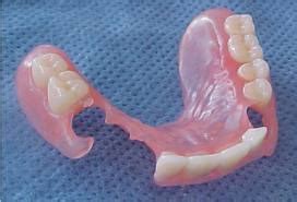 Maybe you would like to learn more about one of these? Dokter Gigi: Gigi Palsu / Denture yang lentur Valplast