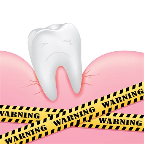 One of the most common dental issues is a cracked tooth. Loose Tooth? Here's What to Do | Loose tooth, Wisdom teeth ...
